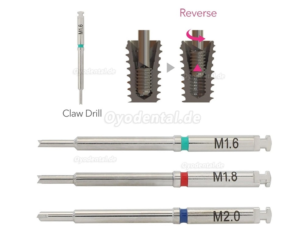Universal Implantat Gebrochene Schraube Entferner Set Fraktur Schrauben Extraktor